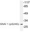 Snail Family Transcriptional Repressor 1 antibody, AP20798PU-N, Origene, Western Blot image 