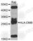 Major Histocompatibility Complex, Class II, DM Beta antibody, A8384, ABclonal Technology, Western Blot image 