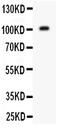 Glutamate Ionotropic Receptor AMPA Type Subunit 1 antibody, PA1587, Boster Biological Technology, Western Blot image 