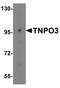Transportin 3 antibody, A03407, Boster Biological Technology, Western Blot image 