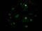 CTD Small Phosphatase 1 antibody, M07398-2, Boster Biological Technology, Immunofluorescence image 