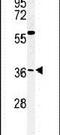 Coiled-Coil Domain Containing 92 antibody, PA5-24939, Invitrogen Antibodies, Western Blot image 