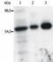 FYN Proto-Oncogene, Src Family Tyrosine Kinase antibody, NB500-517, Novus Biologicals, Immunoprecipitation image 