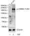 Erb-B2 Receptor Tyrosine Kinase 4 antibody, A00296Y1284, Boster Biological Technology, Western Blot image 