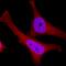Cyclin-dependent kinase inhibitor 2A antibody, AF5779, R&D Systems, Immunofluorescence image 