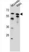 PLAG1 Zinc Finger antibody, AP53329PU-N, Origene, Western Blot image 