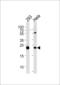 Interleukin 1 Receptor Antagonist antibody, 62-283, ProSci, Western Blot image 