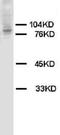 HIF-2-alpha antibody, LS-C171929, Lifespan Biosciences, Western Blot image 