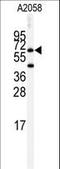 Butyrylcholinesterase antibody, LS-C97232, Lifespan Biosciences, Western Blot image 