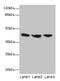 Interleukin 2 Receptor Subunit Gamma antibody, LS-C369827, Lifespan Biosciences, Western Blot image 