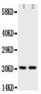 KRAS Proto-Oncogene, GTPase antibody, PA1457, Boster Biological Technology, Western Blot image 