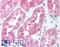 Distal-Less Homeobox 4 antibody, LS-C141173, Lifespan Biosciences, Immunohistochemistry paraffin image 