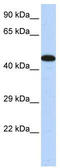 A-kinase anchor protein 5 antibody, TA341549, Origene, Western Blot image 