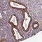 DDB1 And CUL4 Associated Factor 4 antibody, PA5-61485, Invitrogen Antibodies, Immunohistochemistry paraffin image 
