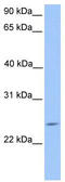 Securin-2 antibody, TA339704, Origene, Western Blot image 