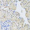 SET Nuclear Proto-Oncogene antibody, LS-C334566, Lifespan Biosciences, Immunohistochemistry paraffin image 