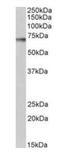 Ribosomal Protein S6 Kinase B1 antibody, orb18737, Biorbyt, Western Blot image 