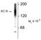 Adenylate Cyclase 3 antibody, AP32981PU-N, Origene, Western Blot image 