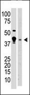 Methyl-CpG Binding Domain Protein 2 antibody, 55-334, ProSci, Western Blot image 