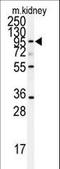 ADAM Metallopeptidase Domain 9 antibody, LS-C100638, Lifespan Biosciences, Western Blot image 