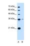 Tetraspanin 5 antibody, NBP1-69337, Novus Biologicals, Western Blot image 