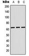 Keratin 84 antibody, orb214176, Biorbyt, Western Blot image 