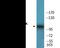 Protein Tyrosine Kinase 2 antibody, EKC2407, Boster Biological Technology, Western Blot image 