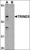 Tripartite Motif Containing 25 antibody, orb88384, Biorbyt, Western Blot image 