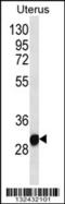 Ring Finger Protein 148 antibody, 56-767, ProSci, Western Blot image 