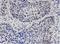 HNF1 Homeobox B antibody, H00006928-M07, Novus Biologicals, Immunohistochemistry paraffin image 