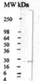 Ciliary Neurotrophic Factor antibody, GTX17692, GeneTex, Western Blot image 