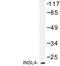 Insulin Like 4 antibody, LS-C177368, Lifespan Biosciences, Western Blot image 