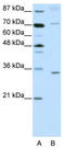 Atonal BHLH Transcription Factor 8 antibody, TA345460, Origene, Western Blot image 