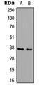 Beta-1,3-Galactosyltransferase 6 antibody, LS-C354287, Lifespan Biosciences, Western Blot image 