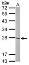 GST3 antibody, GTX112695, GeneTex, Western Blot image 