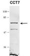 Chaperonin Containing TCP1 Subunit 7 antibody, NBP1-58218, Novus Biologicals, Western Blot image 
