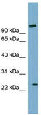 ADP Ribosylation Factor Like GTPase 8B antibody, TA344918, Origene, Western Blot image 