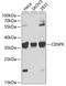 Centromere Protein K antibody, A10647, Boster Biological Technology, Western Blot image 
