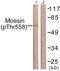 Ezrin antibody, PA5-38679, Invitrogen Antibodies, Western Blot image 