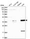 Zinc Finger Protein 771 antibody, HPA030730, Atlas Antibodies, Western Blot image 