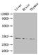 Hepatitis A Virus Cellular Receptor 1 antibody, A50652-100, Epigentek, Western Blot image 