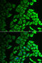 Interleukin 18 Binding Protein antibody, A07261, Boster Biological Technology, Western Blot image 