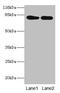 Luteinizing Hormone/Choriogonadotropin Receptor antibody, CSB-PA012911LA01HU, Cusabio, Western Blot image 