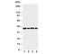 Aurora Kinase B antibody, R30904, NSJ Bioreagents, Western Blot image 