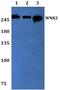 WNK Lysine Deficient Protein Kinase 2 antibody, PA5-37108, Invitrogen Antibodies, Western Blot image 