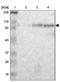 Mediator Complex Subunit 15 antibody, NBP1-89018, Novus Biologicals, Western Blot image 