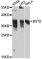 Bone Marrow Stromal Cell Antigen 2 antibody, A12315, ABclonal Technology, Western Blot image 
