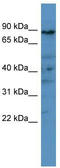 Phosphodiesterase 8A antibody, TA344623, Origene, Western Blot image 