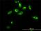 Thiopurine S-Methyltransferase antibody, H00007172-M01, Novus Biologicals, Immunocytochemistry image 