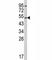 Cytochrome P450 Family 2 Subfamily E Member 1 antibody, F51257-0.4ML, NSJ Bioreagents, Western Blot image 